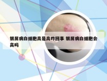 银屑病白细胞高是高咋回事 银屑病白细胞会高吗