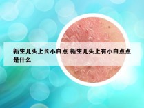 新生儿头上长小白点 新生儿头上有小白点点是什么