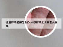 儿童脖子起癣怎么办 小孩脖子上长癣怎么回事