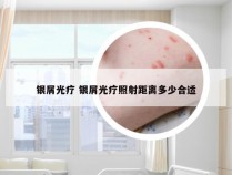 银屑光疗 银屑光疗照射距离多少合适