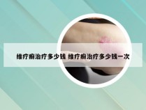 维疗癣治疗多少钱 维疗癣治疗多少钱一次