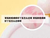 掌跖脓疱病痒好了后怎么还痒 掌跖脓疱病痒好了后怎么还痒呢