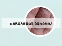 白癜风偏方用醋功效 白醋治白斑秘方