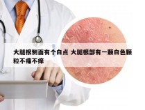 大腿根侧面有个白点 大腿根部有一颗白色颗粒不痛不痒