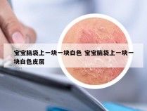 宝宝脑袋上一块一块白色 宝宝脑袋上一块一块白色皮屑