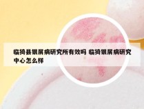 临猗县银屑病研究所有效吗 临猗银屑病研究中心怎么样