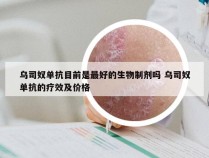 乌司奴单抗目前是最好的生物制剂吗 乌司奴单抗的疗效及价格