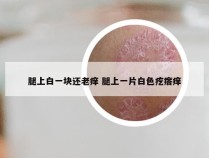 腿上白一块还老痒 腿上一片白色疙瘩痒