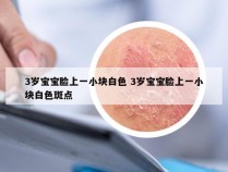 3岁宝宝脸上一小块白色 3岁宝宝脸上一小块白色斑点