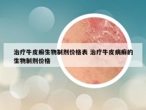 治疗牛皮癣生物制剂价格表 治疗牛皮病癣的生物制剂价格