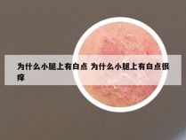 为什么小腿上有白点 为什么小腿上有白点很痒