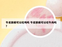 牛皮肤癣可以吃鸡吗 牛皮肤癣可以吃牛肉吗?