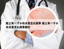 腿上有一个小白点是怎么回事 腿上有一个小白点是怎么回事图片