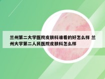 兰州第二大学医院皮肤科谁看的好怎么样 兰州大学第二人民医院皮肤科怎么样