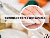 银屑病用什么茶泡水 银屑病用什么泡水喝最好