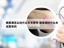 银屑病怎么吃什么补充营养 银屑病吃什么补充营养药