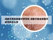 成都华西皮肤医学研究所 成都华西皮肤医学研究所怎么样