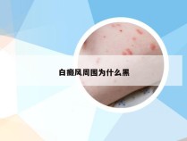 白癜风周围为什么黑