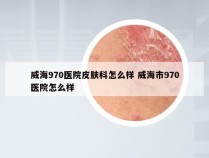 威海970医院皮肤科怎么样 威海市970医院怎么样