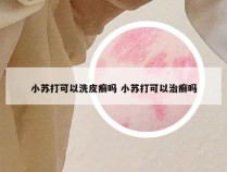 小苏打可以洗皮癣吗 小苏打可以治癣吗