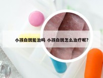 小孩白斑能治吗 小孩白斑怎么治疗呢?