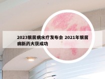 2023银屑病水疗发布会 2021年银屑病新药大获成功