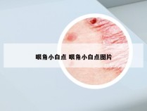 眼角小白点 眼角小白点图片