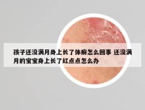 孩子还没满月身上长了体癣怎么回事 还没满月的宝宝身上长了红点点怎么办