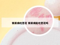 银屑病吃葱花 银屑病能吃葱花吗