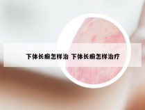 下体长癣怎样治 下体长癣怎样治疗