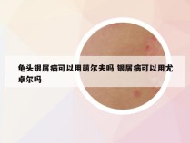 龟头银屑病可以用萌尔夫吗 银屑病可以用尤卓尔吗