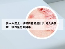 男人头皮上一块块白色的是什么 男人头皮一块一块白是怎么回事