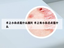 手上小白点是什么图片 手上有小白点点是什么