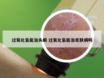 过氧化氢能治头癣 过氧化氢能治皮肤病吗