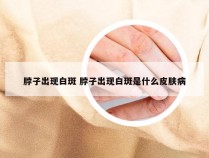 脖子出现白斑 脖子出现白斑是什么皮肤病