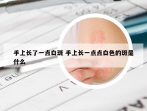 手上长了一点白斑 手上长一点点白色的斑是什么