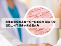 新生儿宝宝脸上有一粒一粒的白点 新生儿宝宝脸上长了很多小白点怎么办