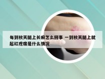 每到秋天腿上长癣怎么回事 一到秋天腿上就起红疙瘩是什么情况