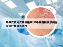 如皋皮防所皮肤病医院 如皋皮防所皮肤病医院治疗祛斑怎么样