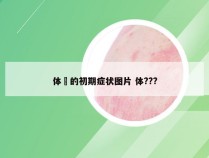 体廯的初期症状图片 体???