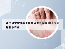 两个月宝宝牙龈上有白点怎么回事 婴儿下牙床有小白点