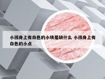 小孩身上有白色的小块是缺什么 小孩身上有白色的小点