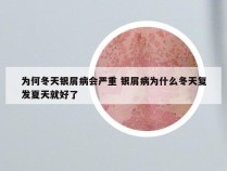 为何冬天银屑病会严重 银屑病为什么冬天复发夏天就好了