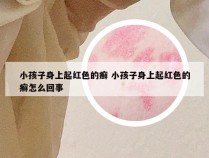 小孩子身上起红色的癣 小孩子身上起红色的癣怎么回事