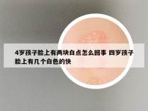 4岁孩子脸上有两块白点怎么回事 四岁孩子脸上有几个白色的快