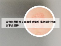 生物制剂停用了会加重病情吗 生物制剂停用会不会反弹