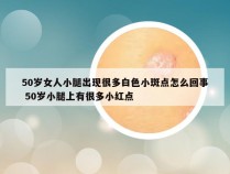 50岁女人小腿出现很多白色小斑点怎么回事 50岁小腿上有很多小红点