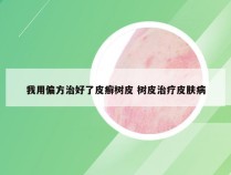 我用偏方治好了皮癣树皮 树皮治疗皮肤病