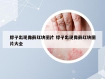 脖子出现像藓红块图片 脖子出现像藓红块图片大全