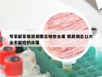 专家解答银屑病要忌哪些水果 银屑病忌口大全不能吃的水果